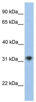 WB Suggested Anti-CHST13 Antibody Titration: 0.2-1 ug/ml; Positive Control: 721_B cell lysate