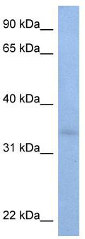 WB Suggested Anti-ST6GALNAC3 Antibody Titration: 0.2-1 ug/ml; Positive Control: HepG2 cell lysate