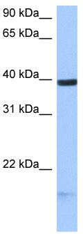 WB Suggested Anti-HS3ST5 Antibody Titration: 0.2-1 ug/ml; Positive Control: MCF7 cell lysate