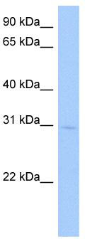 WB Suggested Anti-GSTA5 Antibody Titration: 0.2-1 ug/ml; Positive Control: Hela cell lysate