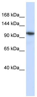 WB Suggested Anti-B4GALNT3 Antibody Titration: 0.2-1 ug/ml; Positive Control: Hela cell lysate