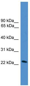 WB Suggested Anti-DGAT2L7 Antibody Titration: 0.2-1 ug/ml; ELISA Titer: 1:1562500; Positive Control: COLO205 cell lysate