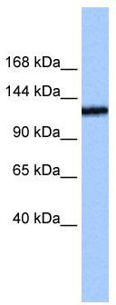 WB Suggested Anti-TEX2 Antibody Titration: 0.2-1 ug/ml; Positive Control: Jurkat cell lysate