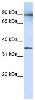 WB Suggested Anti-LRRC59 Antibody Titration: 1 ug/ml; Positive Control: Fetal Lung cell lysate