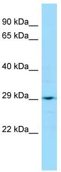 Host: Rabbit; Target Name: LRRC59; Sample Tissue: Jurkat Whole Cell lysates; Antibody Dilution: 1.0ug/ml