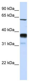 WB Suggested Anti-SMPD3 Antibody Titration: 0.2-1 ug/ml; ELISA Titer: 1:12500; Positive Control: Human Lung