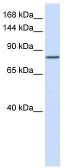 WB Suggested Anti-PCDHAC1 Antibody Titration: 0.2-1 ug/ml; ELISA Titer: 1:62500; Positive Control: Human Lung