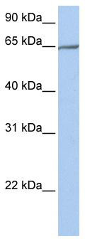 WB Suggested Anti-PCDHA4 Antibody Titration: 0.2-1 ug/ml; Positive Control: 721_B cell lysate