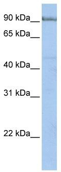 WB Suggested Anti-PCDHA5 Antibody Titration: 0.2-1 ug/ml; Positive Control: Hela cell lysate