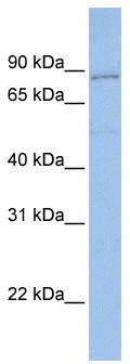 WB Suggested Anti-PCDHGA4 Antibody Titration: 0.2-1 ug/ml; Positive Control: Hela cell lysate