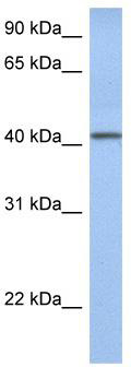 WB Suggested Anti-YIPF1 Antibody Titration: 0.2-1 ug/ml; Positive Control: Human Lung
