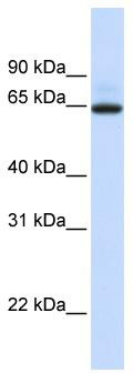 WB Suggested Anti-UGT1A7 Antibody Titration: 0.2-1 ug/ml; ELISA Titer: 1:2500; Positive Control: 721_B cell lysate; There is BioGPS gene expression data showing that UGT1A7 is expressed in 721_B
