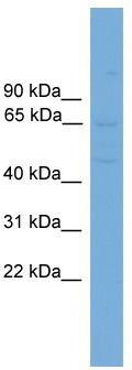 WB Suggested Anti-SLC10A3 Antibody Titration: 0.2-1 ug/ml; Positive Control: Hela cell lysate; SLC10A3 is supported by BioGPS gene expression data to be expressed in HeLa