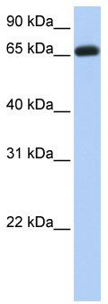 WB Suggested Anti-ENTPD7 Antibody Titration: 0.2-1 ug/ml; Positive Control: Human brain