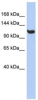 WB Suggested Anti-TMEM63C Antibody Titration: 0.2-1 ug/ml; ELISA Titer: 1: 62500; Positive Control: THP-1 cell lysate