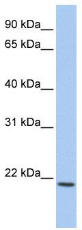 WB Suggested Anti-IL22 Antibody Titration: 0.2-1 ug/ml; Positive Control: Hela cell lysate