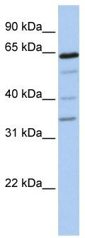 WB Suggested Anti-GALNT16 Antibody Titration: 0.2-1 ug/ml; Positive Control: 721_B cell lysate