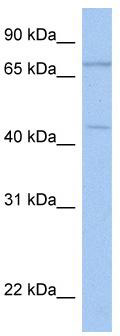 WB Suggested Anti-ISLR2 Antibody Titration: 0.2-1 ug/ml; Positive Control: Hela cell lysate