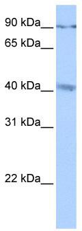 WB Suggested Anti-CATSPERG Antibody Titration: 0.2-1 ug/ml; Positive Control: MCF7 cell lysate