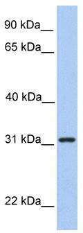 WB Suggested Anti-SRPRB Antibody Titration: 0.2-1 ug/ml; Positive Control: Hela cell lysate. SRPRB is supported by BioGPS gene expression data to be expressed in HeLa