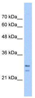 WB Suggested Anti-SRPRB Antibody Titration: 5.0 ug/ml; Positive Control: HepG2 cell lysate