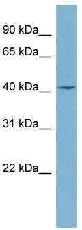 WB Suggested Anti-CERS1 Antibody Titration: 0.2-1 ug/ml; ELISA Titer: 1: 12500; Positive Control: OVCAR-3 cell lysate