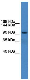 WB Suggested Anti-XYLT1 Antibody Titration: 0.2-1 ug/ml; ELISA Titer: 1: 312500; Positive Control: PANC1 cell lysate