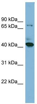 WB Suggested Anti-HERPUD2 Antibody Titration: 0.2-1 ug/ml; ELISA Titer: 1: 62500; Positive Control: NCI-H226 cell lysate