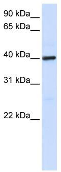WB Suggested Anti-MARC1 Antibody Titration: 0.2-1 ug/ml; ELISA Titer: 1: 1562500; Positive Control: Human Placenta