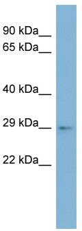 WB Suggested Anti-ARV1 Antibody Titration: 0.2-1 ug/ml; ELISA Titer: 1: 62500; Positive Control: OVCAR-3 cell lysate