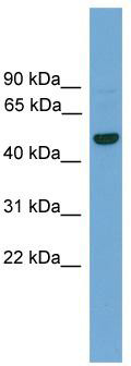 WB Suggested Anti-GRAMD3 Antibody Titration: 0.2-1 ug/ml; ELISA Titer: 1: 312500; Positive Control: Hela cell lysate GRAMD3 is supported by BioGPS gene expression data to be expressed in HeLa