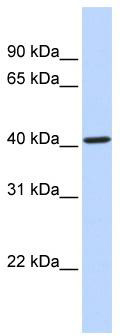 Gel: 15%SDS-PAGE<br>Lysate: 40 μg<br>Lane 1-3: Mouse kidney tissue<br>human testis tissue<br>Human brain malignant glioma tissue<br>Primary antibody: TA368810 (GNA13 Antibody) at dilution 1/450<br>Secondary antibody: Goat anti rabbit IgG at 1/8000 dilution<br>Exposure time: 1 minute