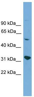 WB Suggested Anti-YIPF2 Antibody Titration: 0.2-1 ug/ml; ELISA Titer: 1: 312500; Positive Control: HepG2 cell lysate
