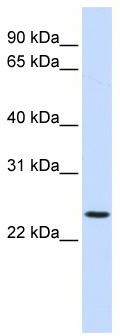 WB Suggested Anti-PRRG3 Antibody Titration: 0.2-1 ug/ml; ELISA Titer: 1: 62500; Positive Control: Jurkat cell lysate