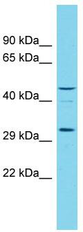 Host: Rabbit; Target Name: RGD1305007; Sample Tissue: Rat Testis lysates; Antibody Dilution: 1.0 ug/ml