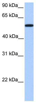 WB Suggested Anti-UGT2A3 Antibody Titration: 0.2-1 ug/ml; Positive Control: NTERA2 cell lysate