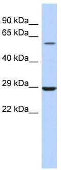 WB Suggested Anti-LPCAT1 Antibody Titration: 0.2-1 ug/ml; ELISA Titer: 1: 312500; Positive Control: Human Small Intestine