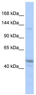 WB Suggested Anti-KIAA0319L Antibody Titration: 0.2-1 ug/ml; ELISA Titer: 1: 1562500; Positive Control: MCF7 cell lysate