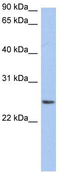 WB Suggested Anti-NRSN2 Antibody Titration: 0.2-1 ug/ml; ELISA Titer: 1: 62500; Positive Control: THP-1 cell lysate