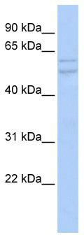 WB Suggested Anti-UXS1 Antibody Titration: 0.2-1 ug/ml; ELISA Titer: 1: 312500; Positive Control: OVCAR-3 cell lysate UXS1 is supported by BioGPS gene expression data to be expressed in OVCAR3