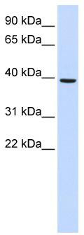 WB Suggested Anti-MOGAT2 Antibody Titration: 0.2-1 ug/ml; ELISA Titer: 1: 312500; Positive Control: Human Liver