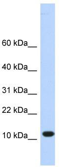WB Suggested Anti-TMEM254 Antibody Titration: 0.2-1 ug/ml; ELISA Titer: 1: 312500; Positive Control: Hela cell lysate