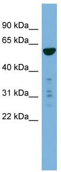 WB Suggested Anti-PTDSS2 Antibody Titration: 0.2-1 ug/ml; ELISA Titer: 1: 312500; Positive Control: 293T cell lysatePTDSS2 is supported by BioGPS gene expression data to be expressed in HEK293T