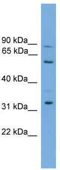 WB Suggested Anti-PTDSS2 Antibody Titration: 0.2-1 ug/ml; ELISA Titer: 1: 312500; Positive Control: 721_B cell lysate