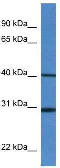 WB Suggested Anti-H13 Antibody; Titration: 1.0 ug/ml; Positive Control: Mouse Spleen