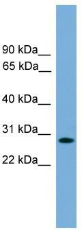 WB Suggested Anti-APOLD1 Antibody Titration: 0.2-1 ug/ml; Positive Control: Jurkat cell lysate