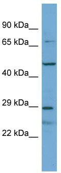 Host: Rabbit; Target Name: APOLD1; Sample Tissue: Hela Whole cell lysates; Antibody Dilution: 1.0 ug/ml