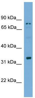 WB Suggested Anti-SPACA1 Antibody Titration: 0.2-1 ug/ml; ELISA Titer: 1: 312500; Positive Control: NCI-H226 cell lysateSPACA1 is supported by BioGPS gene expression data to be expressed in NCIH226