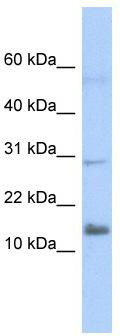 WB Suggested Anti-IFI27L2 Antibody Titration: 0.2-1 ug/ml; ELISA Titer: 1: 62500; Positive Control: Transfected 293T