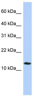 WB Suggested Anti-IFI27L2 Antibody Titration: 0.2-1 ug/ml; ELISA Titer: 1: 62500; Positive Control: Jurkat cell lysate